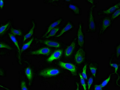 Immunofluorescent analysis of Hela cells using CSB-PA014771LA01HU at dilution of 1:100 and Alexa Fluor 488-congugated AffiniPure Goat Anti-Rabbit IgG(H+L)