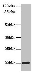 Western blot All lanes: MPV17 antibody at 2microg/ml + Mouse heart tissue Secondary Goat polyclonal to rabbit IgG at 1/10000 dilution Predicted band size: 20 kDa Observed band size: 20 kDa Western blot All lanes: MPV17 antibody at 2microg/ml + Mouse heart tissue Secondary Goat polyclonal to rabbit IgG at 1/10000 dilution Predicted band size: 20 kDa Observed band size: 20 kDa