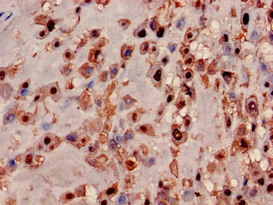 Immunohistochemistry of paraffin-embedded human placenta tissue using CSB-PA014826EA01HU at dilution of 1:100