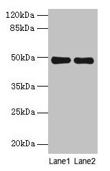 Western blot All lanes: MRPS5 antibody at 5microg/ml Lane 1: Hela whole cell lysate Lane 2: Jurkat whole cell lysate Secondary Goat polyclonal to rabbit IgG at 1/10000 dilution Predicted band size: 49, 28 kDa Observed band size: 49 kDa Western blot All lanes: MRPS5 antibody at 5microg/ml Lane 1: Hela whole cell lysate Lane 2: Jurkat whole cell lysate Secondary Goat polyclonal to rabbit IgG at 1/10000 dilution Predicted band size: 49, 28 kDa Observed band size: 49 kDa