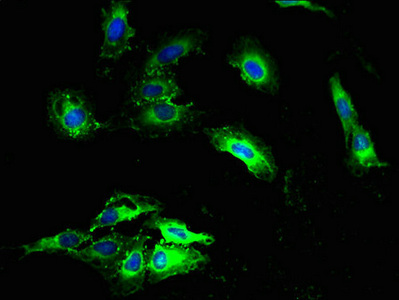 Immunofluorescent analysis of Hela cells using CSB-PA015624EA01HU at dilution of 1:100 and Alexa Fluor 488-congugated AffiniPure Goat Anti-Rabbit IgG(H+L)