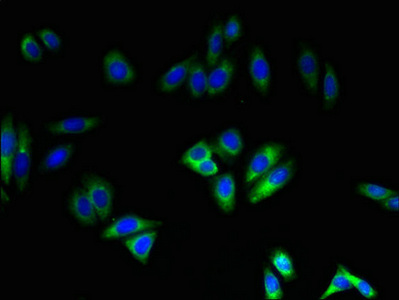 Immunofluorescence(IF) - NOX4 Antibody