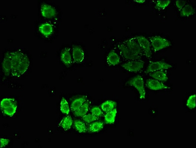 Immunofluorescent analysis of PC-3 cells using CSB-PA016170LA01HU at dilution of 1:100 and Alexa Fluor 488-congugated AffiniPure Goat Anti-Rabbit IgG(H+L)