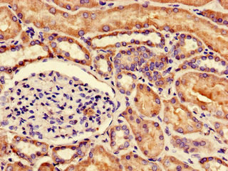 Immunohistochemistry of paraffin-embedded human kidney tissue using CSB-PA016170LA01HU at dilution of 1:100