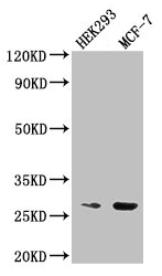 Western Blot Positive WB detected in: HEK293 whole cell lysate, MCF-7 whole cell lysate All lanes: NUDT21 antibody at 2.5microg/ml Secondary Goat polyclonal to rabbit IgG at 1/50000 dilution Predicted band size: 27 kDa Observed band size: 27 kDa Western Blot Positive WB detected in: HEK293 whole cell lysate, MCF-7 whole cell lysate All lanes: NUDT21 antibody at 2.5microg/ml Secondary Goat polyclonal to rabbit IgG at 1/50000 dilution Predicted band size: 27 kDa Observed band size: 27 kDa