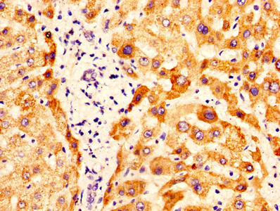 IHC image of CSB-PA017270LA01HU diluted at 1:400 and staining in paraffin-embedded human liver tissue performed on a Leica BondTM system. After dewaxing and hydration, antigen retrieval was mediated by high pressure in a citrate buffer (pH 6.0). Section was blocked with 10% normal goat serum 30min at RT. Then primary antibody (1% BSA) was incubated at 4°C overnight. The primary is detected by a biotinylated secondary antibody and visualized using an HRP conjugated SP system. IHC image of CSB-PA017270LA01HU diluted at 1:400 and staining in paraffin-embedded human liver tissue performed on a Leica BondTM system. After dewaxing and hydration, antigen retrieval was mediated by high pressure in a citrate buffer (pH 6.0). Section was blocked with 10% normal goat serum 30min at RT. Then primary antibody (1% BSA) was incubated at 4°C overnight. The primary is detected by a biotinylated secondary antibody and visualized using an HRP conjugated SP system.