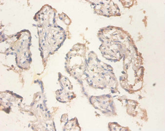 Immunohistochemistry of paraffin-embedded human placenta tissue using CSB-PA01874A0Rb at dilution of 1:100