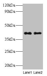 Western blot All lanes: QPCT antibody at 2microg/ml Lane 1: Rat muscle tissue Lane 2: Rat adrenal gland tissue Secondary Goat polyclonal to rabbit IgG at 1/10000 dilution Predicted band size: 41, 36 kDa Observed band size: 41 kDa Western blot All lanes: QPCT antibody at 2microg/ml Lane 1: Rat muscle tissue Lane 2: Rat adrenal gland tissue Secondary Goat polyclonal to rabbit IgG at 1/10000 dilution Predicted band size: 41, 36 kDa Observed band size: 41 kDa