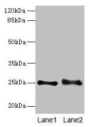 Western blot All lanes: RAB3B antibody at 4microg/ml Lane 1: Mouse brain tissue Lane 2: U87 whole cell lysate Secondary Goat polyclonal to rabbit IgG at 1/10000 dilution Predicted band size: 25 kDa Observed band size: 25 kDa Western blot All lanes: RAB3B antibody at 4microg/ml Lane 1: Mouse brain tissue Lane 2: U87 whole cell lysate Secondary Goat polyclonal to rabbit IgG at 1/10000 dilution Predicted band size: 25 kDa Observed band size: 25 kDa