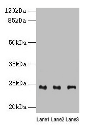 Western blot All lanes: RAB4B antibody at 4microg/ml Lane 1: Mouse stomach tissue Lane 2: Mouse kidney tissue Lane 3: Mouse gonadal tissue Secondary Goat polyclonal to rabbit IgG at 1/10000 dilution Predicted band size: 24, 28 kDa Observed band size: 24 kDa