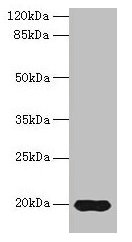 Western blot All lanes: Reg3g antibody at 14microg/ml + Mouse kidney tissue Secondary Goat polyclonal to rabbit IgG at 1/10000 dilution Predicted band size: 20 kDa Observed band size: 20 kDa Western blot All lanes: Reg3g antibody at 14microg/ml + Mouse kidney tissue Secondary Goat polyclonal to rabbit IgG at 1/10000 dilution Predicted band size: 20 kDa Observed band size: 20 kDa