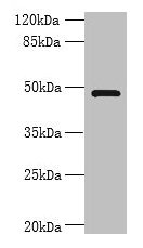 Western blot All lanes: RNF26 antibody at 6microg/ml + 293T whole cell lysate Secondary Goat polyclonal to rabbit IgG at 1/10000 dilution Predicted band size: 48 kDa Observed band size: 48 kDa Western blot All lanes: RNF26 antibody at 6microg/ml + 293T whole cell lysate Secondary Goat polyclonal to rabbit IgG at 1/10000 dilution Predicted band size: 48 kDa Observed band size: 48 kDa