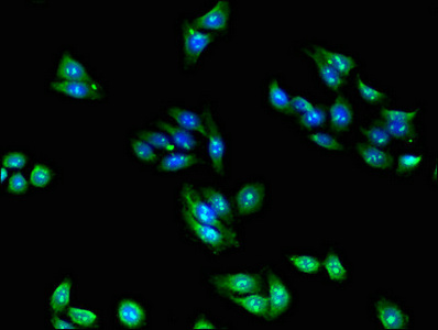 Immunofluorescent analysis of HepG2 cells using CSB-PA020217EA01HU at dilution of 1:100
