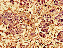 Immunohistochemistry of paraffin-embedded human pancreatic tissue using CSB-PA020217EA01HU at dilution of 1:100