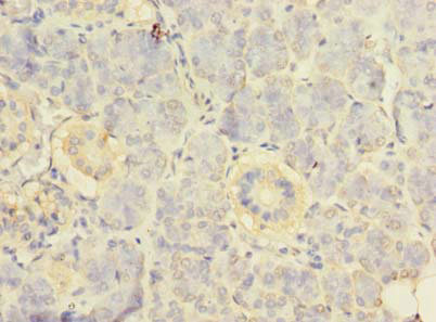 Immunohistochemistry of paraffin-embedded human pancreatic tissue using CSB-PA020402LA01HU at dilution of 1:100 Immunohistochemistry of paraffin-embedded human pancreatic tissue using CSB-PA020402LA01HU at dilution of 1:100
