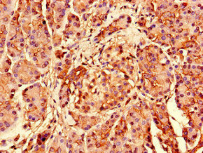 Immunohistochemistry of paraffin-embedded human pancreatic tissue using CSB-PA020407LA01HU at dilution of 1:100 Immunohistochemistry of paraffin-embedded human pancreatic tissue using CSB-PA020407LA01HU at dilution of 1:100