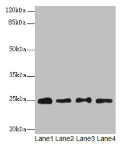 Western blot All lanes: RPS8 antibody at 6microg/ml Lane 1: HL60 whole cell lysate Lane 2: THP-1 whole cell lysate Lane 3: 293T whole cell lysate Lane 4: Mouse liver tissue Secondary Goat polyclonal to rabbit IgG at 1/10000 dilution Predicted band size: 25 kDa Observed band size: 25 kDa Western blot All lanes: RPS8 antibody at 6microg/ml Lane 1: HL60 whole cell lysate Lane 2: THP-1 whole cell lysate Lane 3: 293T whole cell lysate Lane 4: Mouse liver tissue Secondary Goat polyclonal to rabbit IgG at 1/10000 dilution Predicted band size: 25 kDa Observed band size: 25 kDa