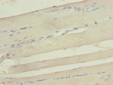 Immunohistochemistry of paraffin-embedded human skeletal muscle tissue using CSB-PA021034LA01HU at dilution of 1:100 Immunohistochemistry of paraffin-embedded human skeletal muscle tissue using CSB-PA021034LA01HU at dilution of 1:100
