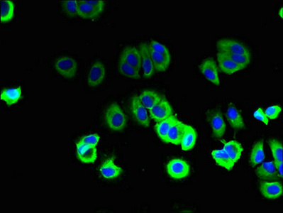 Immunofluorescent analysis of MCF-7 cells using CSB-PA021164LA01HU at dilution of 1:100 and Alexa Fluor 488-congugated AffiniPure Goat Anti-Rabbit IgG(H+L) Immunofluorescent analysis of MCF-7 cells using CSB-PA021164LA01HU at dilution of 1:100 and Alexa Fluor 488-congugated AffiniPure Goat Anti-Rabbit IgG(H+L)