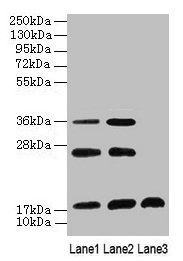 Western Blot All lanes: SFT2D2 antibody at 8microg/ml Lane 1: Mouse liver tissue Lane 2: Mouse kidney tissue Lane 3: Mouse thymus tissue Secondary Goat polyclonal to rabbit IgG at 1/10000 dilution Predicted band size: 18 kDa Observed band size: 18, 26, 36 kDa