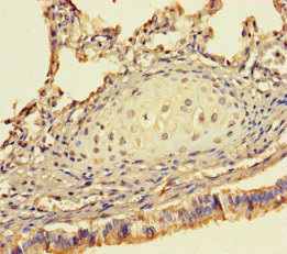 Immunohistochemistry of paraffin-embedded human lung tissue using CSB-PA021263LA01HU at dilution of 1:100