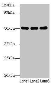 Western blot All lanes: SIGLEC6 antibody at 6microg/ml Lane 1: Human high value serum Lane 2: A549 whole cell lysate Lane 3: Caco-2 whole cell lysate Secondary Goat polyclonal to rabbit IgG at 1/10000 dilution Predicted band size: 50, 39, 49, 38, 43, 45 kDa Observed band size: 50 kDa Western blot All lanes: SIGLEC6 antibody at 6microg/ml Lane 1: Human high value serum Lane 2: A549 whole cell lysate Lane 3: Caco-2 whole cell lysate Secondary Goat polyclonal to rabbit IgG at 1/10000 dilution Predicted band size: 50, 39, 49, 38, 43, 45 kDa Observed band size: 50 kDa