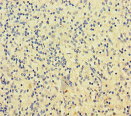 Immunohistochemistry of paraffin-embedded human spleen tissue using CSB-PA021370LA01HU at dilution of 1:100 Immunohistochemistry of paraffin-embedded human spleen tissue using CSB-PA021370LA01HU at dilution of 1:100