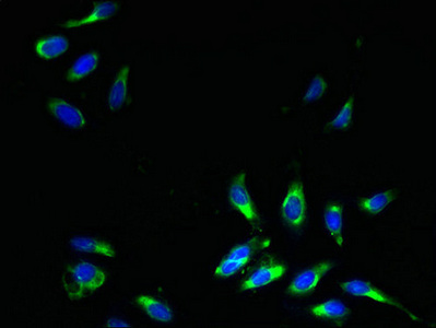 Immunofluorescent analysis of Hela cells using CSB-PA021577LA01HU at dilution of 1:100 and Alexa Fluor 488-congugated AffiniPure Goat Anti-Rabbit IgG(H+L)