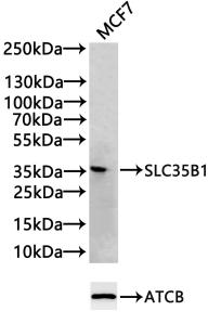 Western blot All lanes: SLC35B1 antibody at 4microg/ml + HL60 whole cell lysate Secondary Goat polyclonal to rabbit IgG at 1/10000 dilution Predicted band size: 36, 40 kDa Observed band size: 36 kDa Western blot All lanes: SLC35B1 antibody at 4microg/ml + HL60 whole cell lysate Secondary Goat polyclonal to rabbit IgG at 1/10000 dilution Predicted band size: 36, 40 kDa Observed band size: 36 kDa