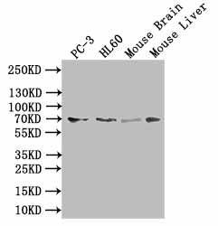 Western blot All lanes: SLC6A6 antibody at 0.5microg/ml + Human placenta tissue Secondary Goat polyclonal to rabbit IgG at 1/10000 dilution Predicted band size: 70, 23 kDa Observed band size: 70 kDa Western blot All lanes: SLC6A6 antibody at 0.5microg/ml + Human placenta tissue Secondary Goat polyclonal to rabbit IgG at 1/10000 dilution Predicted band size: 70, 23 kDa Observed band size: 70 kDa