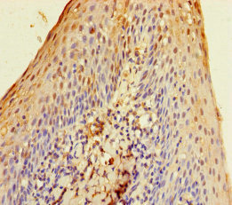 Immunohistochemistry of paraffin-embedded human tonsil tissue using CSB-PA021784LA01HU at dilution of 1:100 Immunohistochemistry of paraffin-embedded human tonsil tissue using CSB-PA021784LA01HU at dilution of 1:100