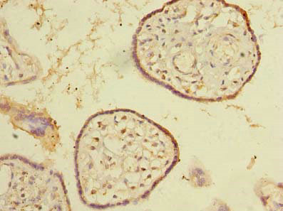 Immunohistochemistry of paraffin-embedded human placenta tissue using CSB-PA022360LA01HU at dilution of 1:100 Immunohistochemistry of paraffin-embedded human placenta tissue using CSB-PA022360LA01HU at dilution of 1:100