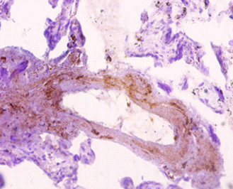 Immunohistochemistry of paraffin-embedded human placenta tissue using CSB-PA022366EA01HU at dilution of 1:10