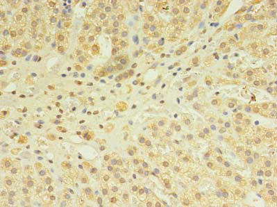 Immunohistochemistry of paraffin-embedded human adrenal gland tissue using CSB-PA022369HA01HU at dilution of 1:100