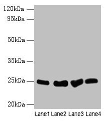 Western blot All lanes: Socs3 antibody at 12microg/ml Lane 1: K562 whole cell lysate Lane 2: A375 whole cell lysate Lane 3: Hela whole cell lysate Lane 4: HepG2 whole cell lysate Secondary Goat polyclonal to rabbit IgG at 1/10000 dilution Predicted band size: 25 kDa Observed band size: 25 kDa Western blot All lanes: Socs3 antibody at 12microg/ml Lane 1: K562 whole cell lysate Lane 2: A375 whole cell lysate Lane 3: Hela whole cell lysate Lane 4: HepG2 whole cell lysate Secondary Goat polyclonal to rabbit IgG at 1/10000 dilution Predicted band size: 25 kDa Observed band size: 25 kDa