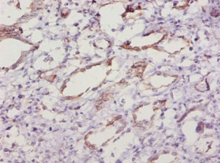 Immunohistochemistry of paraffin-embedded human kidney tissue using CSB-PA022397LA01MO at dilution of 1:10 Immunohistochemistry of paraffin-embedded human kidney tissue using CSB-PA022397LA01MO at dilution of 1:10
