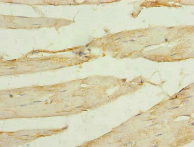 Immunohistochemistry of paraffin-embedded human skeletal muscle tissue using CSB-PA022406LA01HU at dilution of 1:100