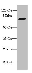 Western blot All lanes: SORBS3 antibody at 8microg/ml + HepG2 whole cell lysate Secondary Goat polyclonal to rabbit IgG at 1/10000 dilution Predicted band size: 76, 37 kDa Observed band size: 76 kDa Western blot All lanes: SORBS3 antibody at 8microg/ml + HepG2 whole cell lysate Secondary Goat polyclonal to rabbit IgG at 1/10000 dilution Predicted band size: 76, 37 kDa Observed band size: 76 kDa