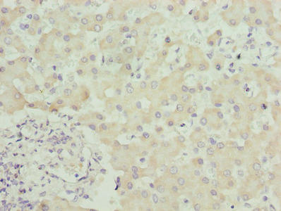 Immunohistochemistry of paraffin-embedded human liver tissue using CSB-PA022517LA01HU at dilution of 1:100