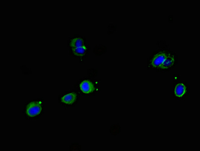 Immunofluorescent analysis of Hela cells using CSB-PA022674LA01HU at dilution of 1:100 and Alexa Fluor 488-congugated AffiniPure Goat Anti-Rabbit IgG(H+L)