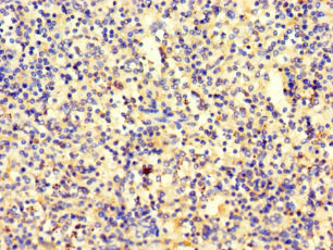 Immunohistochemistry of paraffin-embedded human spleen tissue using CSB-PA022674LA01HU at dilution of 1:100 Immunohistochemistry of paraffin-embedded human spleen tissue using CSB-PA022674LA01HU at dilution of 1:100