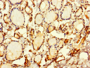 Immunohistochemistry of paraffin-embedded human thyroid tissue using CSB-PA022674LA01HU at dilution of 1:100