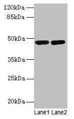 Western blot All lanes: SSB antibody at 2microg/ml Lane 1: Mouse liver tissue Lane 2: Mouse brain tissue Secondary Goat polyclonal to rabbit IgG at 1/10000 dilution Predicted band size: 47 kDa Observed band size: 47 kDa Western blot All lanes: SSB antibody at 2microg/ml Lane 1: Mouse liver tissue Lane 2: Mouse brain tissue Secondary Goat polyclonal to rabbit IgG at 1/10000 dilution Predicted band size: 47 kDa Observed band size: 47 kDa