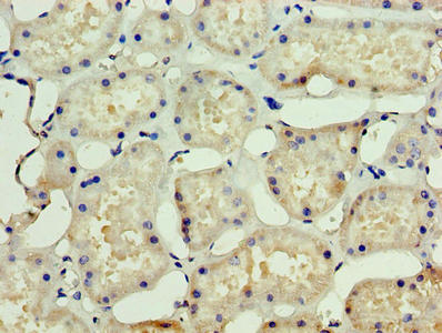 Immunohistochemistry of paraffin-embedded human kidney tissue using CSB-PA022722HA01HU at dilution of 1:100