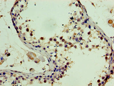 Immunohistochemistry of paraffin-embedded human testis tissue using CSB-PA022722HA01HU at dilution of 1:100