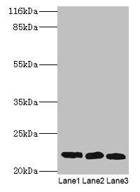 Western blot All lanes: SSSCA1 antibody at 2microg/ml Lane 1: A549 whole cell lysate Lane 2: MCF-7 whole cell lysate Lane 3: 293T whole cell lysate Secondary Goat polyclonal to rabbit IgG at 1/10000 dilution Predicted band size: 22 kDa Observed band size: 22 kDa