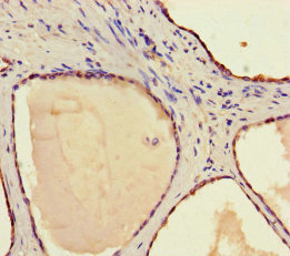 CSB-PA022794HA01HU