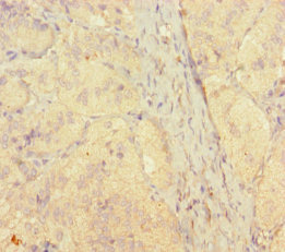 CSB-PA022794HA01HU