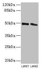 CSB-PA022794HA01HU