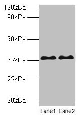 Western blot All lanes: SUPT3H antibody at 2microg/ml Lane 1: Mouse brain tissue Lane 2: Colo320 whole cell lysate Secondary Goat polyclonal to rabbit IgG at 1/10000 dilution Predicted band size: 36, 38 kDa Observed band size: 36 kDa Western blot All lanes: SUPT3H antibody at 2microg/ml Lane 1: Mouse brain tissue Lane 2: Colo320 whole cell lysate Secondary Goat polyclonal to rabbit IgG at 1/10000 dilution Predicted band size: 36, 38 kDa Observed band size: 36 kDa